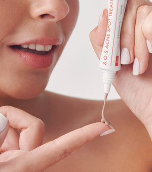Sos Acne Spot Treatment 15ml