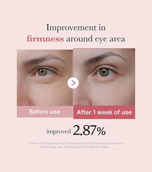 Pdrn Pink Peptide Eye Cream 30ml