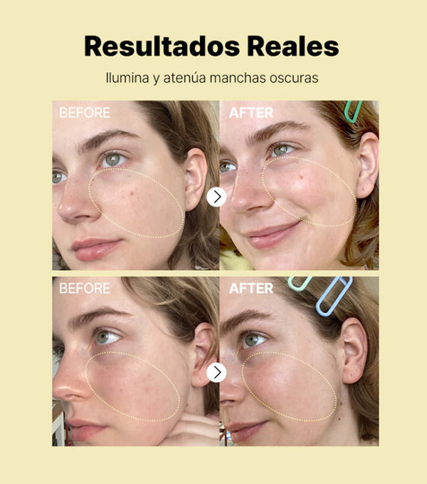 COSRX ADVANCED THE VITAMIN C 23 SERUM 20g | Serum con 23% de Vitamina C pura